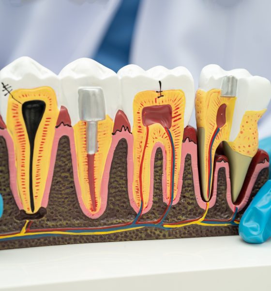 Researchers Explore Baricitinib