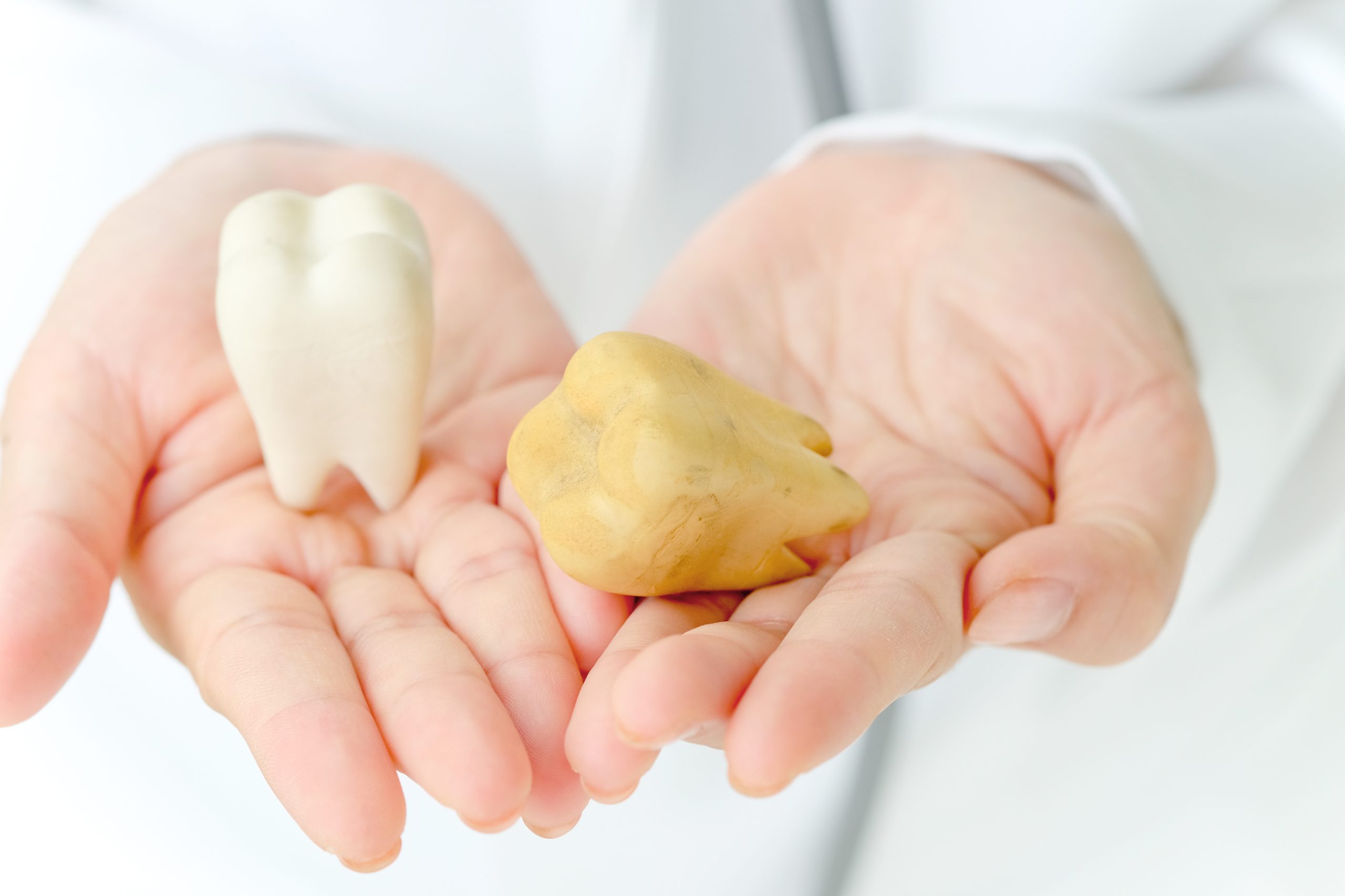 Do All People Have Wisdom Teeth? Understanding the Third Molars